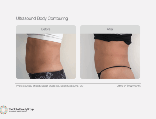 Exciting News: Advanced Body Contouring, Fat Cavitation & Skin Tightening Coming This November!