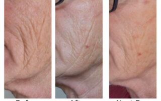 Luxury Radiance Renewal Facial