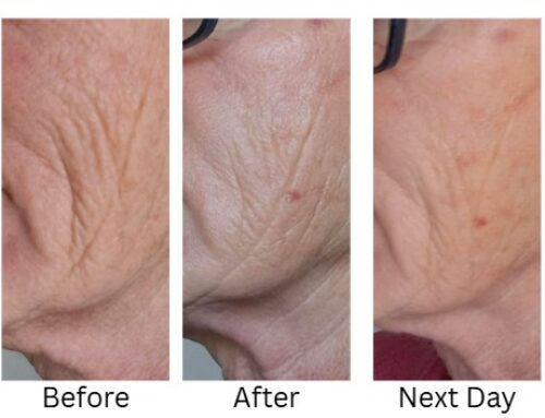 Reclaim your Glow: Luxurious Radiance Renewal 4 in 1 Facial